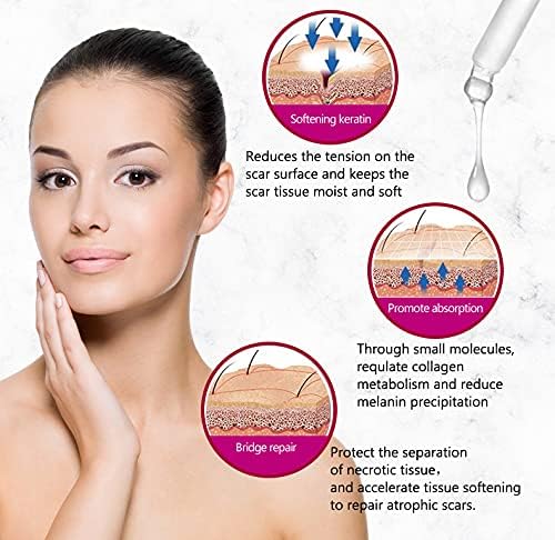 Aichun Beauty Scar Removal Facial Serum Pimples Stretch Marks Face Moisturizing Body Remove Scars Kojic Acid | Vitamin – E | 30ml