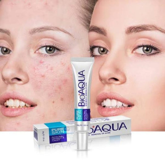 Bioaqua Anti Acne Cream Acne Scar Removal Cream | Best Quality Scar Removal Cream 30g