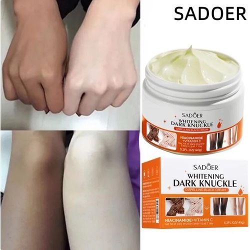 Sadoer 7days Vitamin C Whitening Dark Knuckle Black Knee Cream Niacinamide Vitamin C Dark Spot Corrector Remover 140g